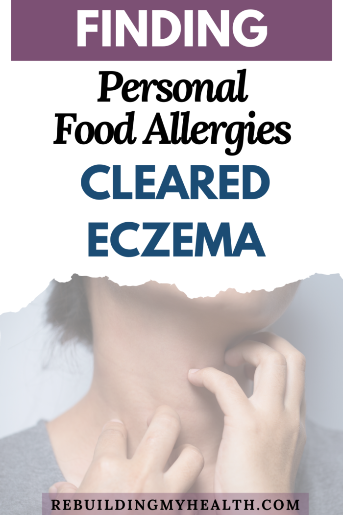 How Finding Personal Food Allergies Cleared Severe Eczema Rebuilding