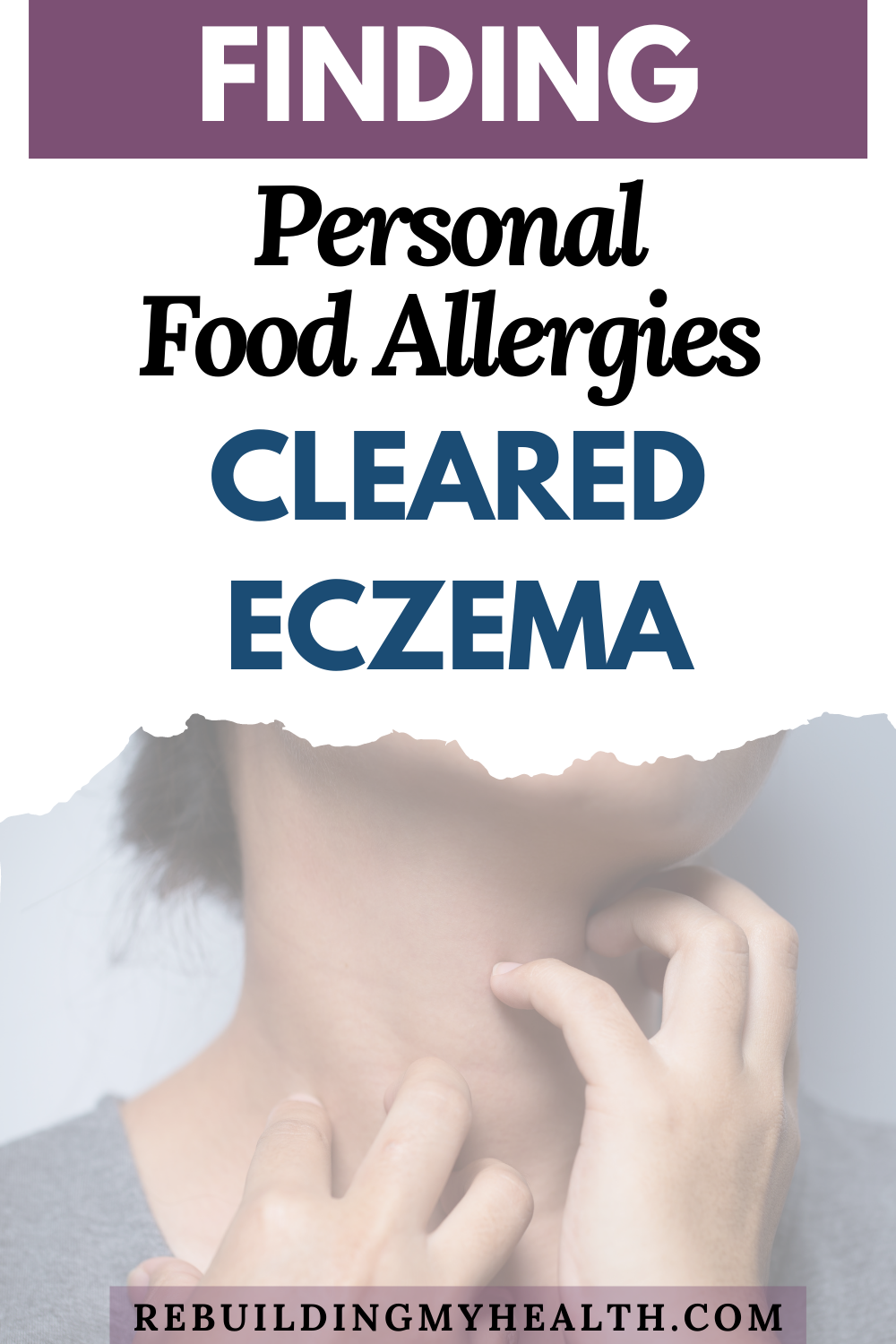 Learn about eczema and food allergies. After intense exercise, a paleo diet and supplements contributed to severe eczema, Nattha cleared it with an elimination diet and by reducing her stress.