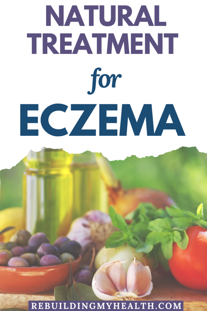 Learn about natural treatment for eczema. A Texas woman found natural eczema remedies, including diet, sulfate-free products and natural oils.